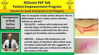 ROJoson PEP Talk: MANAGEMENT OF BODY SURFACE ABSCESS | PPTX