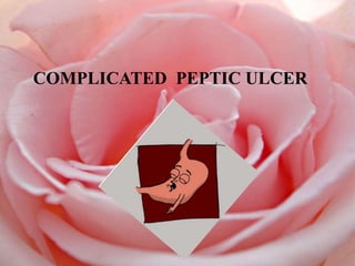 COMPLICATED PEPTIC ULCER
 