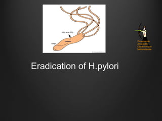 Eradication of H.pylori
Omeprazole
Amoxicillin
Clarithromycin
Metronidazole
 