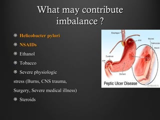 What may contributeWhat may contribute
imbalance ?imbalance ?
Helicobacter pyloriHelicobacter pylori
NSAIDsNSAIDs
EthanolEthanol
TobaccoTobacco
Severe physiologicSevere physiologic
stress (Burns, CNS trauma,stress (Burns, CNS trauma,
Surgery, Severe medical illness)Surgery, Severe medical illness)
SteroidsSteroids
 