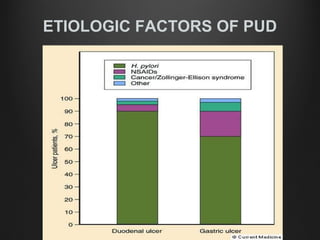 ETIOLOGIC FACTORS OF PUD
 