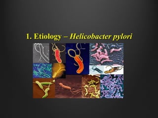 1. Etiology –1. Etiology – Helicobacter pyloriHelicobacter pylori
 