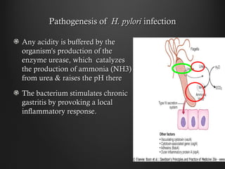 Pathogenesis ofPathogenesis of H. pyloriH. pylori infectioninfection
Any acidity is buffered by theAny acidity is buffered by the
organism's production of theorganism's production of the
enzyme urease, which catalyzesenzyme urease, which catalyzes
the production of ammonia (NH3)the production of ammonia (NH3)
from urea & raises the pH therefrom urea & raises the pH there
The bacterium stimulates chronicThe bacterium stimulates chronic
gastritis by provoking a localgastritis by provoking a local
inflammatory response.inflammatory response.
 