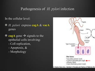 Pathogenesis ofPathogenesis of H. pyloriH. pylori infectioninfection
In the cellular level:In the cellular level:
H. pyloriH. pylori expressexpress cagAcagA && vacAvacA
genesgenes
cagAcagA genegene  signals to thesignals to the
epithelial cells involving:epithelial cells involving:
- Cell replication,- Cell replication,
- Apoptosis, &- Apoptosis, &
- Morphology- Morphology
 