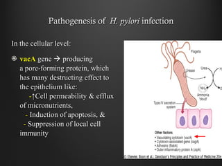 Pathogenesis ofPathogenesis of H. pyloriH. pylori infectioninfection
In the cellular level:In the cellular level:
vacAvacA genegene  producingproducing
a pore-forming protein, whicha pore-forming protein, which
has many destructing effect tohas many destructing effect to
the epithelium like:the epithelium like:
--↑Cell permeability & efflux↑Cell permeability & efflux
of micronutrients,of micronutrients,
-- Induction of apoptosis, &Induction of apoptosis, &
-- Suppression of local cellSuppression of local cell
immunityimmunity
 
