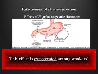 Pathogenesis ofPathogenesis of H. pyloriH. pylori infectioninfection
- ↓ Somatostatin production from antral D-cells due to antral gastritis
- Low somatostatin will ↑Gastrin release from G-cell 
hypergastrinemia
- This will stimulate acid production by the parietal cells  leading to
further duodenal ulceration.
Effects of H. pylori on gastric Hormones
This effect is exaggerated among smokers!
 
