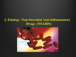 2. Etiology -Non-Steroidal Anti-inflammatory2. Etiology -Non-Steroidal Anti-inflammatory
Drugs (NSAIDS)Drugs (NSAIDS)
 
