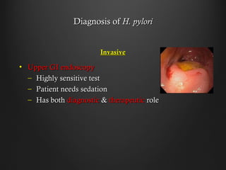 Diagnosis ofDiagnosis of H. pyloriH. pylori
InvasiveInvasive
• Upper GI endoscopyUpper GI endoscopy
– Highly sensitive testHighly sensitive test
– Patient needs sedationPatient needs sedation
– Has bothHas both diagnosticdiagnostic && therapeutictherapeutic rolerole
 