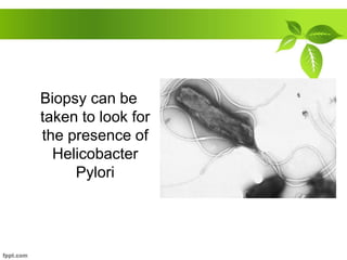 Biopsy can be
taken to look for
the presence of
Helicobacter
Pylori
 