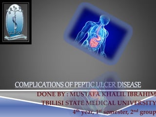 COMPLICATIONS OF PEPTIC ULCER DISEASE
DONE BY : MUSTAFA KHALIL IBRAHIM
TBILISI STATE MEDICAL UNIVERSITY
4th year, 1st semester, 2nd group
 