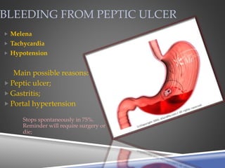BLEEDING FROM PEPTIC ULCER
 Melena
 Tachycardia
 Hypotension
Main possible reasons:
 Peptic ulcer;
 Gastritis;
 Portal hypertension
Stops spontaneously in 75%.
Reminder will require surgery or
die;
 
