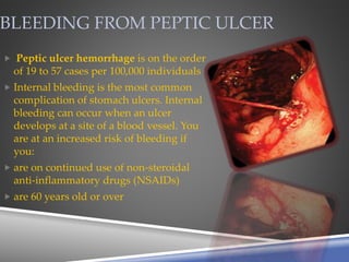 BLEEDING FROM PEPTIC ULCER
 Peptic ulcer hemorrhage is on the order
of 19 to 57 cases per 100,000 individuals
 Internal bleeding is the most common
complication of stomach ulcers. Internal
bleeding can occur when an ulcer
develops at a site of a blood vessel. You
are at an increased risk of bleeding if
you:
 are on continued use of non-steroidal
anti-inflammatory drugs (NSAIDs)
 are 60 years old or over
 