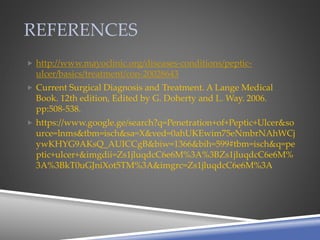 REFERENCES
 http://www.mayoclinic.org/diseases-conditions/peptic-
ulcer/basics/treatment/con-20028643
 Current Surgical Diagnosis and Treatment. A Lange Medical
Book. 12th edition, Edited by G. Doherty and L. Way. 2006.
pp:508-538.
 https://www.google.ge/search?q=Penetration+of+Peptic+Ulcer&so
urce=lnms&tbm=isch&sa=X&ved=0ahUKEwim75eNmbrNAhWCj
ywKHYG9AKsQ_AUICCgB&biw=1366&bih=599#tbm=isch&q=pe
ptic+ulcer+&imgdii=Zs1jluqdcC6e6M%3A%3BZs1jluqdcC6e6M%
3A%3BkT0uGJniXot5TM%3A&imgrc=Zs1jluqdcC6e6M%3A
 