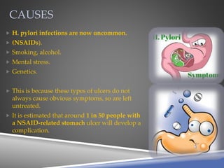 CAUSES
 H. pylori infections are now uncommon.
 (NSAIDs).
 Smoking, alcohol.
 Mental stress.
 Genetics.
 This is because these types of ulcers do not
always cause obvious symptoms, so are left
untreated.
 It is estimated that around 1 in 50 people with
a NSAID-related stomach ulcer will develop a
complication.
 