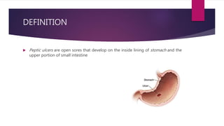 DEFINITION
 Peptic ulcers are open sores that develop on the inside lining of stomach and the
upper portion of small intestine
 