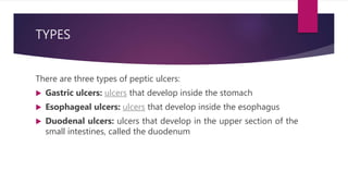 TYPES
There are three types of peptic ulcers:
 Gastric ulcers: ulcers that develop inside the stomach
 Esophageal ulcers: ulcers that develop inside the esophagus
 Duodenal ulcers: ulcers that develop in the upper section of the
small intestines, called the duodenum
 