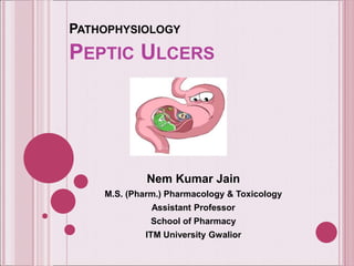 PATHOPHYSIOLOGY
PEPTIC ULCERS
Nem Kumar Jain
M.S. (Pharm.) Pharmacology & Toxicology
Assistant Professor
School of Pharmacy
ITM University Gwalior
 