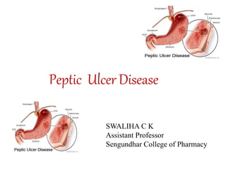 Peptic Ulcer Disease
SWALIHA C K
Assistant Professor
Sengundhar College of Pharmacy
 
