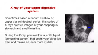Hampton Line Peptic ulcer ( a medical study)- definition, causes, pathophysiology ...