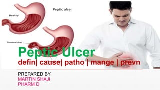PREPARED BY
MARTIN SHAJI
PHARM D
Peptic Ulcer
defin| cause| patho | mange | prevn
 