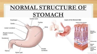 NORMAL STRUCTURE OF
STOMACH
 