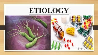 ETIOLOGY
 