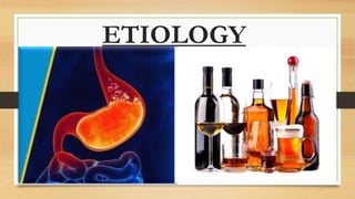 ETIOLOGY
 