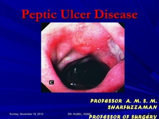 Peptic Ulcer Disease




                                          PROFESSOR A. M. S. M.
                                               SHARFUZZAMAN
Sunday, November 18, 2012   DR. RUBEL, SSMC                 1
                                         PROFESSOR OF SURGERY
 