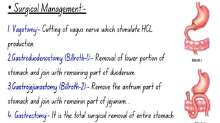 PEPTIC ULCER SLIDESHARE 
