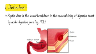 PEPTIC ULCER SLIDESHARE 