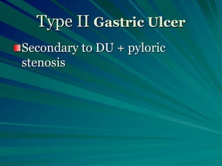 Type II Gastric Ulcer
Secondary to DU + pyloric
stenosis
 