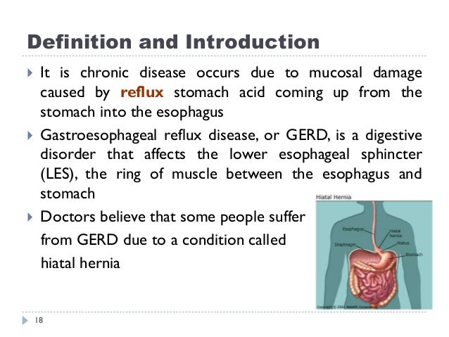 Gastroesophageal reflux disease and ulcers