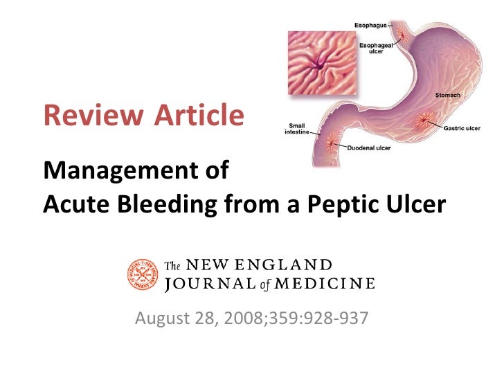 Peptic Ulcer Bleeding