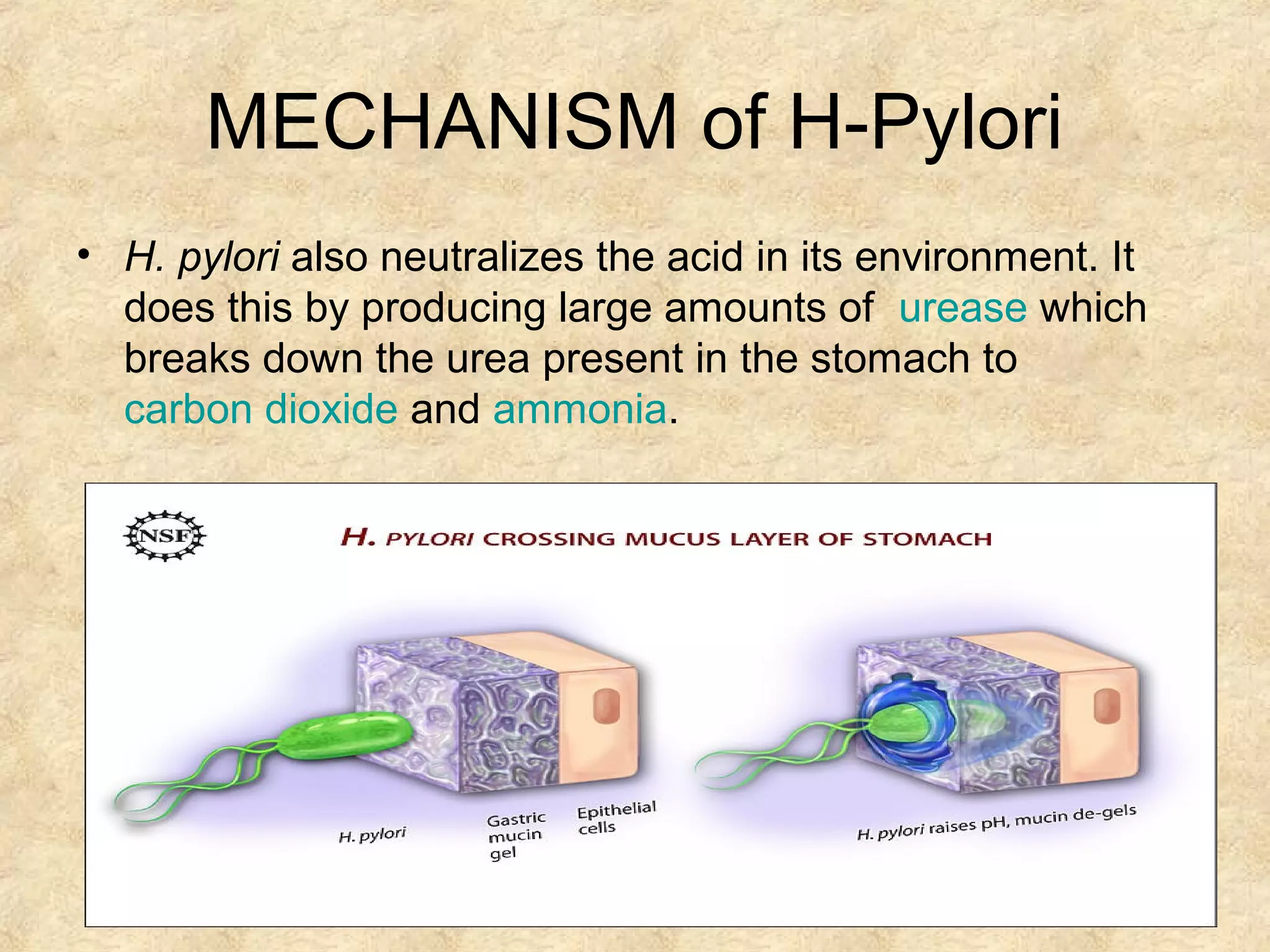 Peptic ulcer disease causes and treatment | PPT