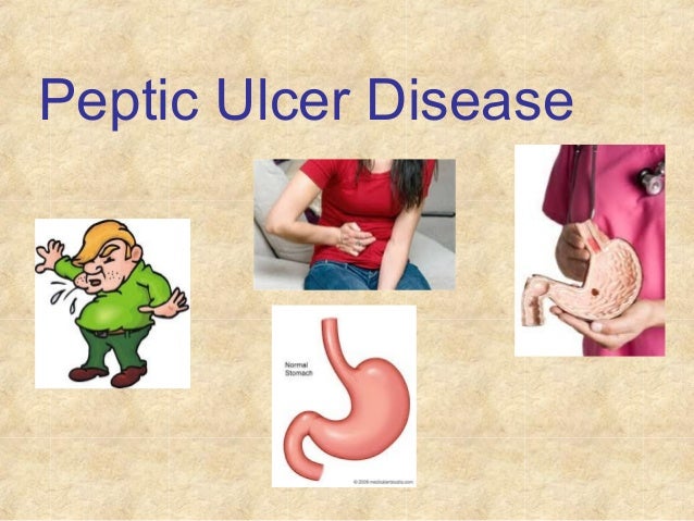 Peptic ulcer disease causes and treatment