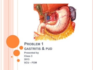 PROBLEM 1
GASTRITIS & PUD
Presented by
Class 3
2013
SCU – FOM
 