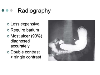 Radiography
 Less expensive
 Require barium
 Most ulcer (90%)
diagnosed
accurately
 Double contrast
> single contrast
 