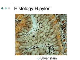 Histology H.pylori
 Silver stain
 