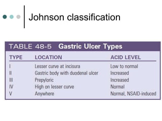 Johnson classification
 