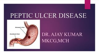 PEPTIC ULCER DISEASE
DR. AJAY KUMAR
MKCG,MCH
 