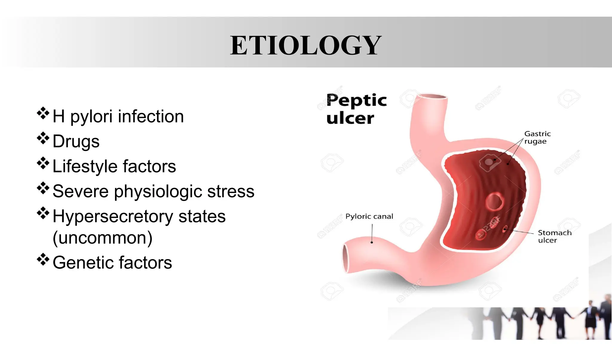 ETIOLOGY
H pylori infection
Drugs
Lifestyle factors
Severe physiologic stress
Hypersecretory states
(uncommon)
Genetic factors
 