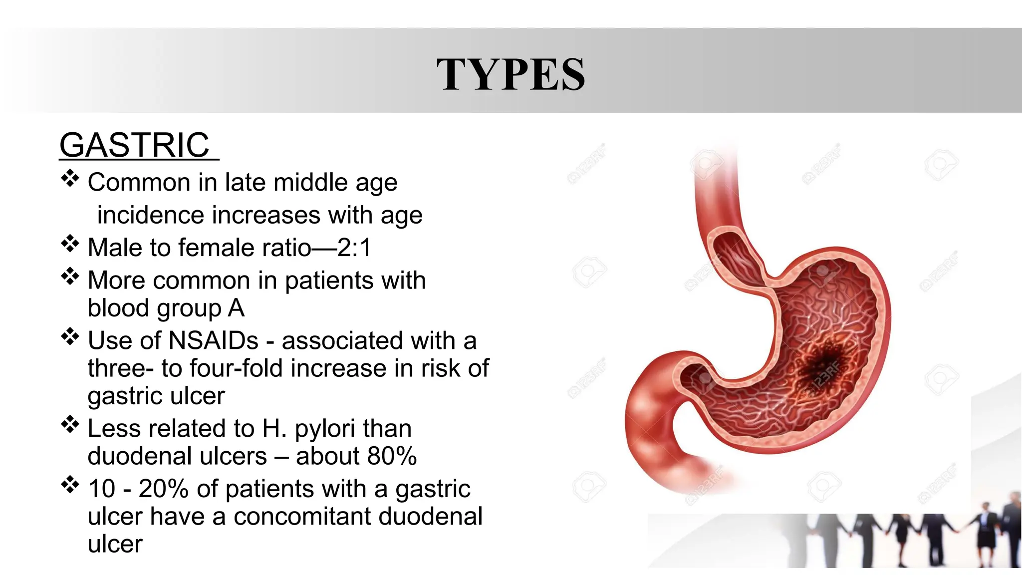 TYPES
GASTRIC
 Common in late middle age
incidence increases with age
 Male to female ratio—2:1
 More common in patients with
blood group A
 Use of NSAIDs - associated with a
three- to four-fold increase in risk of
gastric ulcer
 Less related to H. pylori than
duodenal ulcers – about 80%
 10 - 20% of patients with a gastric
ulcer have a concomitant duodenal
ulcer
 