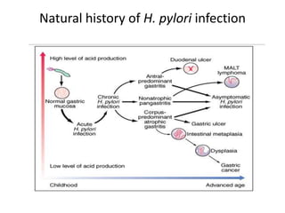 Natural history of H. pylori infection
 