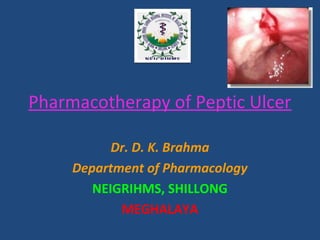 Pharmacotherapy of Peptic Ulcer
Dr. D. K. Brahma
Department of Pharmacology
NEIGRIHMS, SHILLONG
MEGHALAYA
 