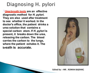 Ureabreath tests are an effective
diagnostic method for H. pylori.
They are also used after treatment
to see whether it worked. In the
doctor's office, the patient drinks a
urea solution that contains a
special carbon atom. If H. pylori is
present, it breaks down the urea,
releasing the carbon. The blood
carries the carbon to the lungs,
where the patient exhales it. The
breath is accurate.
Edited by :-MR . ROMAN BAJRANG
 