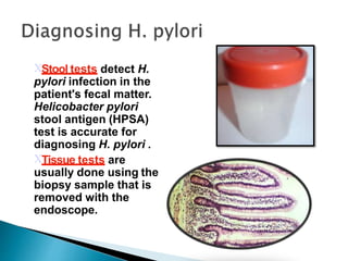 Stool tests detect H.
pylori infection in the
patient's fecal matter.
Helicobacter pylori
stool antigen (HPSA)
test is accurate for
diagnosing H. pylori .
Tissue tests are
usually done using the
biopsy sample that is
removed with the
endoscope.
 
