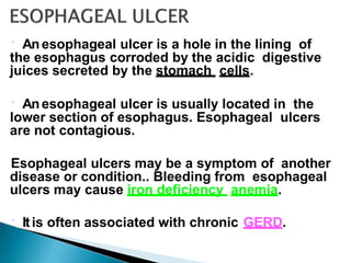Anesophageal ulcer is a hole in the lining of
the esophagus corroded by the acidic digestive
juices secreted by the stomach cells.
Anesophageal ulcer is usually located in the
lower section of esophagus. Esophageal ulcers
are not contagious.
Esophageal ulcers may be a symptom of another
disease or condition.. Bleeding from esophageal
ulcers may cause iron deficiency anemia.
Itis often associated with chronic GERD.
 