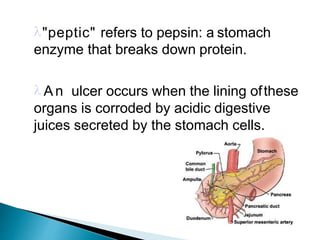 "peptic" refers to pepsin: a stomach
enzyme that breaks down protein.
 An ulcer occurs when the lining ofthese
organs is corroded by acidic digestive
juices secreted by the stomach cells.
 