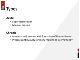 Types
Acute
• Superficial erosion
• Minimal erosion
Chronic
• Muscular wall erosion with formation of fibrous tissue
• Present continuously for many months or intermittently
 