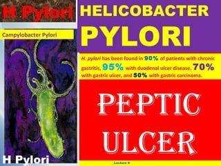 H Pylori HELICOBACTER
Campylobacter Pylori

PYLORI

H. pylori has been found in 90% of patients with chronic
gastritis, 95% with duodenal ulcer disease, 70%
with gastric ulcer, and 50% with gastric carcinoma.

H Pylori

PePtic
ulcer
Lecture 8

 